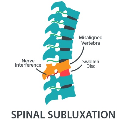 Chiropractic Frederick MD Spine Subluxation