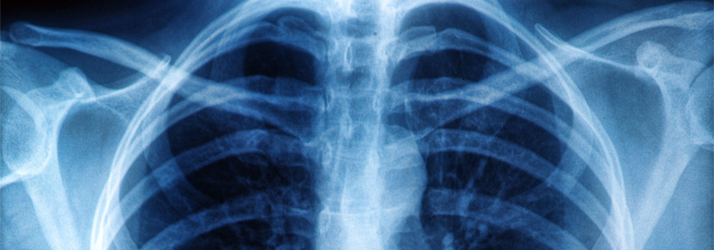 Chiropractic Frederick MD X-rays Chiropractic Frederick MD X-rays
